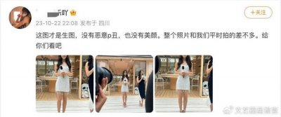 ​赵今麦活动生图小腿外翻有很多疤痕，穿恨天高也挽救不了身材比例