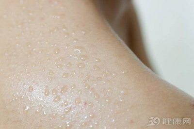 ​身体经常出汗有啥好处 身体总出汗是哪里出了问题